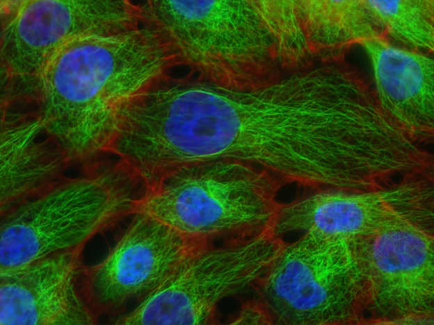 Advantages of using antibody sequencing services
