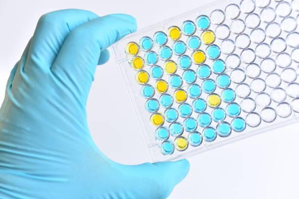 what is the elisa test, elisa test kit