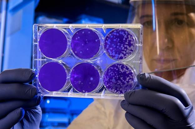 custom protein expression