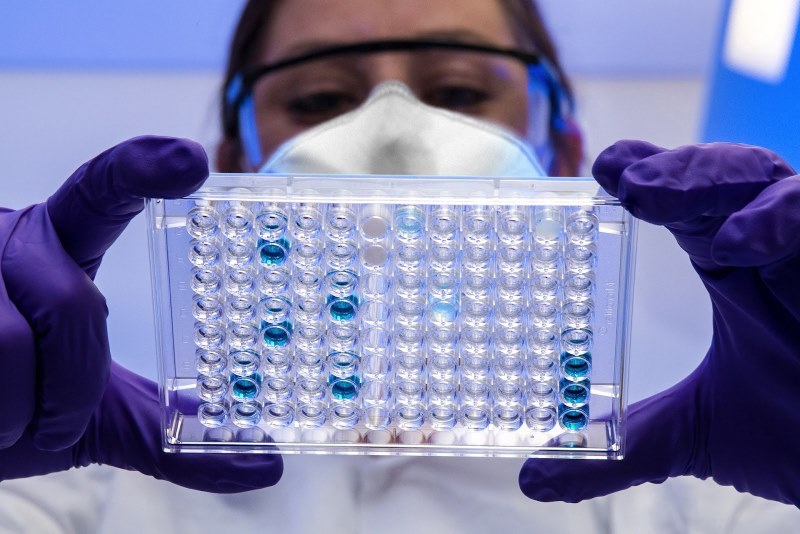 Recombinant Protein Production, Custom Protein Synthesis